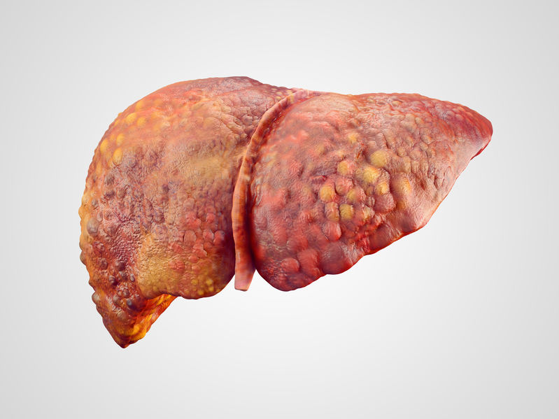 sickliver.jpg